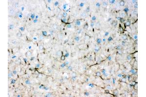 Immunohistochemistry (IHC) image for anti-Internexin Neuronal Intermediate Filament Protein, alpha (INA) (AA 71-161) antibody (ABIN4886634)