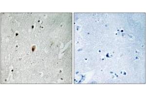 Immunohistochemistry (IHC) image for anti-Protein Kinase, DNA-Activated, Catalytic Polypeptide (PRKDC) (AA 2613-2662), (pThr2647) antibody (ABIN1531582)