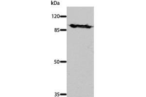 Western Blot analysis of Mouse brain tissue using DNM1 Polyclonal Antibody at dilution of 1:700 (Dynamin 1 Antikörper)