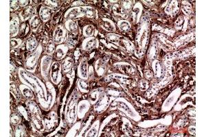 Immunohistochemistry (IHC) analysis of paraffin-embedded Human Kidney, antibody was diluted at 1:100. (M-CSF/CSF1 Antikörper  (Internal Region))
