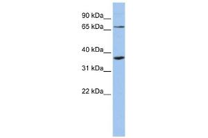 WB Suggested Anti-ZNF274 Antibody Titration:  0. (ZNF274 Antikörper  (Middle Region))