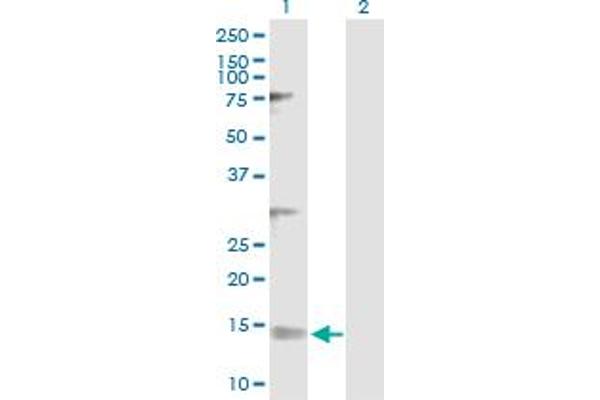 NDUFV3 抗体  (AA 1-108)