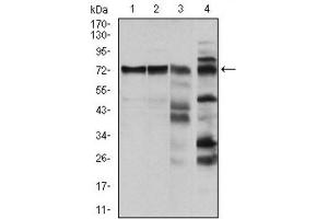 Western Blotting (WB) image for anti-V-Raf-1 Murine Leukemia Viral Oncogene Homolog 1 (RAF1) antibody (ABIN1844891) (RAF1 Antikörper)