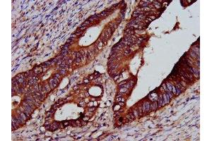 Immunohistochemistry (IHC) image for anti-Protein tyrosine Phosphatase Type IVA, Member 2 (PTP4A2) (AA 1-164) antibody (ABIN7166237)