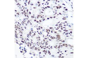 Immunohistochemistry (IHC) image for anti-Squamous Cell Carcinoma Antigen Recognized By T Cells 3 (SART3) (AA 664-963) antibody (ABIN6147392)
