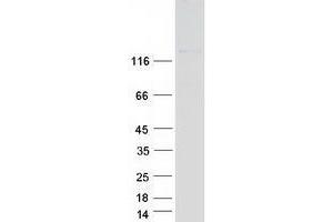 ABL2 Protein (ABL2) (Transcript Variant C) (Myc-DYKDDDDK Tag)
