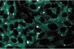 Immunofluorescence staining on human endothelial cells. (MAP2K5 Antikörper  (AA 13-188))