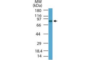 Western blot analysis of PRDM5 in HL-60 cell lysate using PRDM5 polyclonal antibody  at 1 ug/mL . (PRDM5 Antikörper  (AA 100-200))