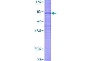 Frizzled Family Receptor 7 (FZD7) (AA 1-574) protein (GST tag)