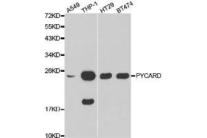 Western blot analysis of extracts of various cell lines, using PYCARD antibody (ABIN5970516).