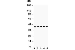 Western blot testing of Fas antibody and Lane 1:  HeLa;  2: Jurkat;  3: A549;  4: SMMC-7721;  5: K562 lysate