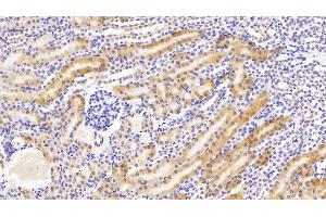 Detection of PCK1 in Mouse Kidney Tissue using Polyclonal Antibody to Phosphoenolpyruvate Carboxykinase 1, Soluble (PCK1) (PCK1 Antikörper  (AA 312-563))