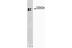 Western blot analysis of p150 [Glued] on a rat cerebrum lysate (left). (Dynactin 1 Antikörper  (AA 3-202))