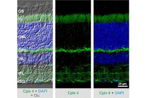 Indirect immunostaining of mouse retina (dilution 1 : 2000). (Complexin 4 Antikörper)