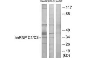 Western blot analysis of extracts from HepG2/COLO205 cells, using hnRNP C1/C2 Antibody.