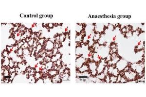 Staining Methods (StM) image for anti-CD63 (CD63) (AA 120-175) antibody (ABIN1440014)