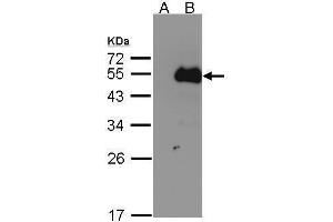 WB Image Western Blot analysis of NFIB expression in transfected 293T cell line by NFIB polyclonal antibody. (NFIB Antikörper)