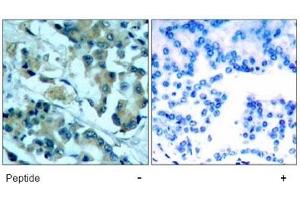 Image no. 1 for anti-Mitogen-Activated Protein Kinase Kinase 1 (MAP2K1) (Ser217) antibody (ABIN197430)