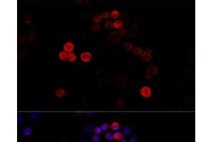 Immunofluorescence analysis of HeLa cells using FLNA Polyclonal Antibody at dilution of 1:100 (40x lens). (Filamin A Antikörper)