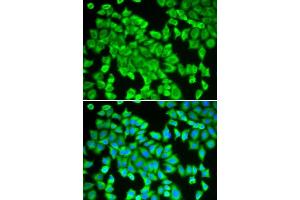 Immunofluorescence analysis of HeLa cells using STIP1 antibody. (STIP1 Antikörper  (AA 1-300))
