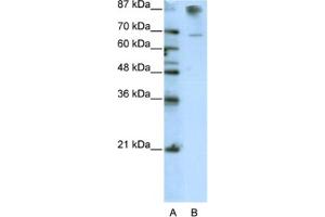 Western Blotting (WB) image for anti-HKR1, GLI-Kruppel Zinc Finger Family Member (HKR1) antibody (ABIN2462014) (HKR1 Antikörper)