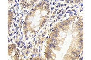 Immunohistochemistry analysis of paraffin-embedded human colon using CDC25A Polyclonal Antibody at dilution of 1:1000. (CDC25A Antikörper)
