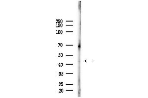 anti-Aryl Hydrocarbon Receptor Interacting Protein-Like 1 (AIPL1) (C-Term) antibody