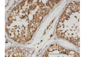 Immunostaining (ISt) image for anti-Angiopoietin-Like 3 (ANGPTL3) (AA 17-460) antibody (ABIN525967)