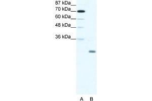 WB Suggested Anti-ID4 Antibody Titration:  1. (ID4 Antikörper  (N-Term))