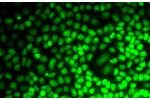 Immunofluorescence analysis of MCF7 cells using CCNE2 Polyclonal Antibody (Cyclin E2 Antikörper)