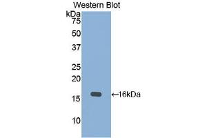 Western blot analysis of the recombinant protein. (KRT15 Antikörper  (AA 274-399))