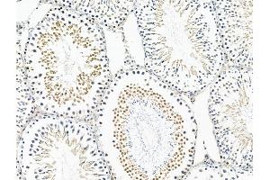 ABIN6263956 and ABIN6268907 at 1/100 staining Rat testis tissue by IHC-P. (p300 Antikörper  (N-Term))