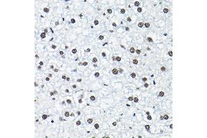 Immunohistochemistry of paraffin-embedded mouse liver using SNRP Rabbit pAb (2161) at dilution of 1:200 (40x lens). (SNRPA1 Antikörper  (AA 1-220))