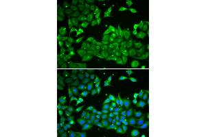 Immunofluorescence analysis of HeLa cells using ALDH3A1 antibody. (ALDH3A1 Antikörper)
