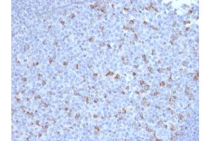 Formalin-fixed, paraffin-embedded human Tonsil stained with PD1 (CD279) Mouse Monoclonal Antibody (PDCD1/2720). (PD-1 Antikörper)