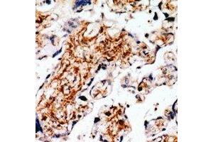Immunohistochemical analysis of RLK staining in human placenta formalin fixed paraffin embedded tissue section. (TXK Antikörper)