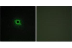 Immunofluorescence (IF) image for anti-Cyclin B3 (CCNB3) (AA 1221-1270) antibody (ABIN2889635) (Cyclin B3 Antikörper  (AA 1221-1270))