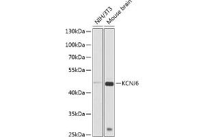 Western blot analysis of extracts of various cell lines, using KCNJ6 antibody (ABIN6129433, ABIN6142742, ABIN6142743 and ABIN6225263) at 1:1000 dilution. (KCNJ6 Antikörper  (AA 1-80))