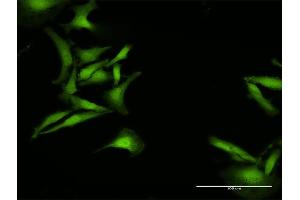 Immunofluorescence of purified MaxPab antibody to C1orf38 on HeLa cell.