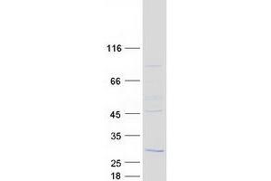 RD3 Protein (Myc-DYKDDDDK Tag)