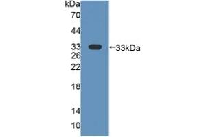 Detection of Recombinant FMO2, Human using Polyclonal Antibody to Flavin Containing Monooxygenase 2, Non Functional (FMO2) (FMO2 Antikörper  (AA 295-469))