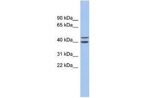 WB Suggested Anti-FBXL14 Antibody Titration: 0. (FBXL14 Antikörper  (N-Term))
