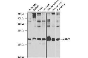 Western blot analysis of extracts of various cell lines, using  Antibody (ABIN6129197, ABIN6137129, ABIN6137130 and ABIN6223718) at 1:1000 dilution. (ARPC3 Antikörper  (AA 1-178))