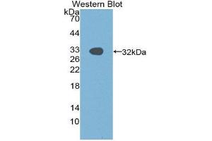 Western Blotting (WB) image for anti-P21-Activated Kinase 1 (PAK1) (AA 252-501) antibody (ABIN1869663) (PAK1 Antikörper  (AA 252-501))