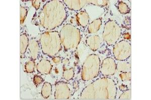 Immunohistochemistry (IHC) image for anti-Pleckstrin Homology Domain Containing, Family A (phosphoinositide Binding Specific) Member 1 (PLEKHA1) (AA 285-404) antibody (ABIN7163636)