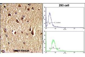 (LEFT)Formalin-fixed and paraffin-embedded human brain tissue reacted with FKHR Antibody (Center ), which was peroxidase-conjugated to the secondary antibody, followed by DAB staining. (FOXO1 Antikörper  (AA 454-482))