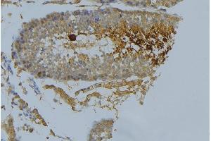 Immunohistochemistry (IHC) image for anti-Adducin 1 (Alpha) (ADD1) antibody (ABIN6259794)