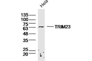 Hela lysates probed with TRIM23 Polyclonal Antibody, Unconjugated  at 1:300 dilution and 4˚C overnight incubation. (TRIM23 Antikörper  (AA 201-300))