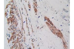 IHC-P analysis of Human Stomach Tissue, with DAB staining. (VEGFR2/CD309 Antikörper  (AA 46-320))