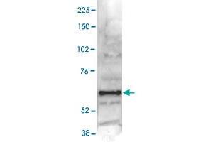 Nuclear extracts of HeLa cells (40 ug) were analysed by Western blot using PAPD4 polyclonal antibody  diluted 1 : 1,000 in TBS-Tween containing 5% skimmed milk.